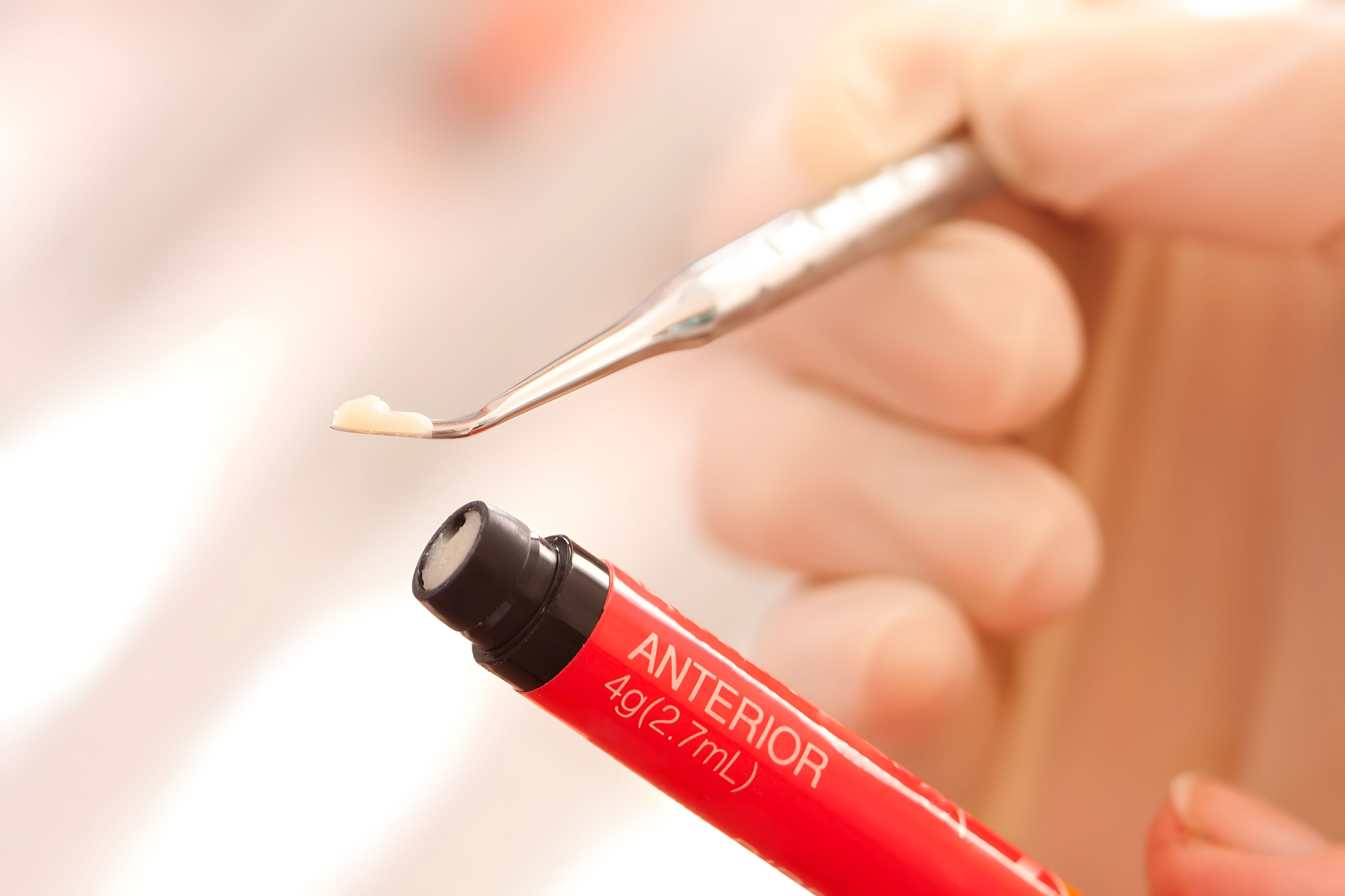 Tooth with a newly placed composite filling  natural colour match